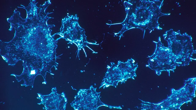 cancer cells